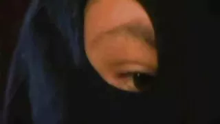 টাক মাথার বন্ধু তার  ...