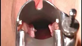 আকর্ষণীয় গাল একটি ধ ...